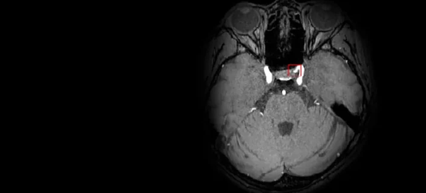 DEEP:NEURO